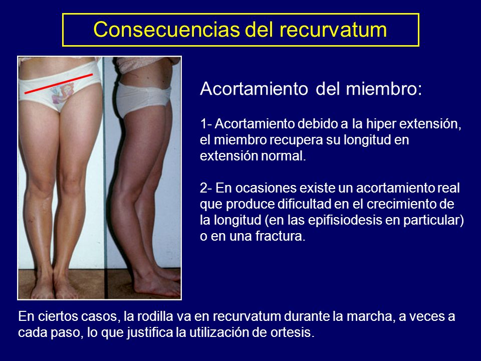 Como aumentar el pene que ejercicio